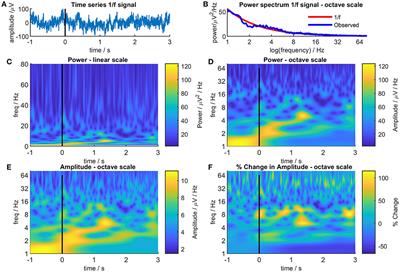 How Conventional Visual Representations of Time-Frequency Analyses Bias Our Perception of EEG/MEG Signals and What to Do About It
